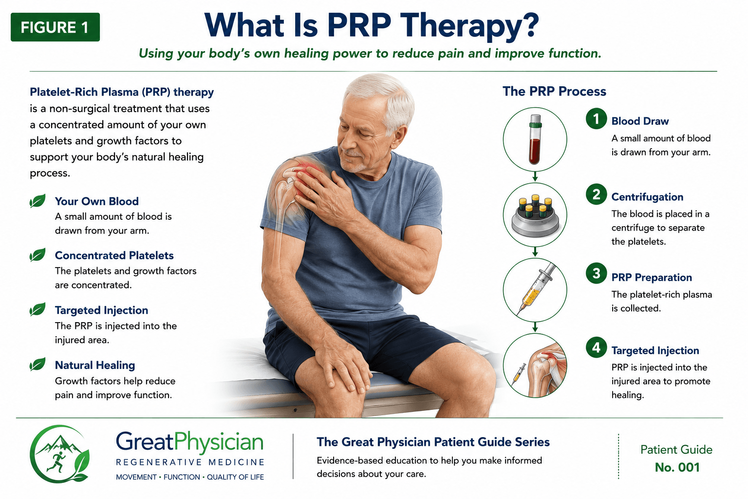Figure 1: What is PRP therapy? The four-step PRP process: blood draw, centrifugation, PRP preparation, and targeted injection.
